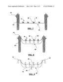 Concrete Form Brace diagram and image