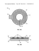 REMOVABLE HEAT MANAGEMENT FOR RECHARGE COILS diagram and image