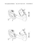 HOLDER MECHANISM FOR A MULTI-FUNCTION ELECTRONIC DEVICE diagram and image