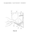 TIME DELAY PRODUCT PUSHING SYSTEM diagram and image