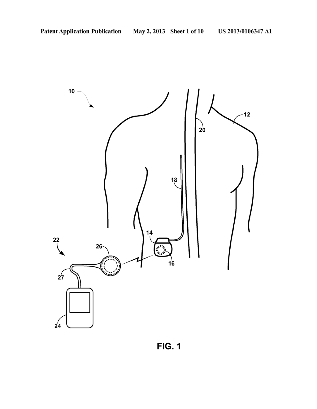 HEAT MANAGEMENT FOR RECHARGE COILS FOR IMPLANTABLE MEDICAL DEVICES - diagram, schematic, and image 02