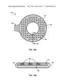 HEAT MANAGEMENT FOR RECHARGE COILS FOR IMPLANTABLE MEDICAL DEVICES diagram and image