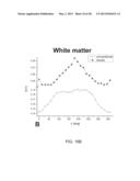 MAGNETIC RESONANCE ANALYSIS USING A PLURALITY OF PAIRS OF BIPOLAR GRADIENT     PULSES diagram and image