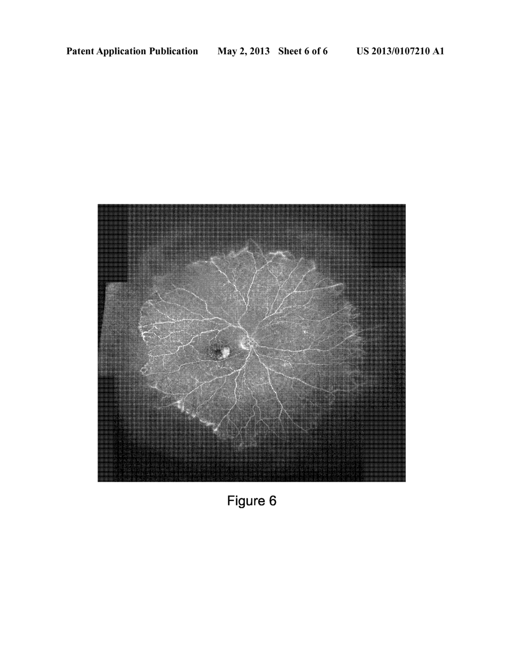 SYSTEMS AND METHODS FOR WIDEFIELD MAPPING OF THE RETINA - diagram, schematic, and image 07