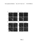 Method for treating cancer pain and/or rescuing analgesic effect of     morphine treatment of cancer pain diagram and image