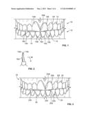 COSMETIC DENTAL PROCESS diagram and image