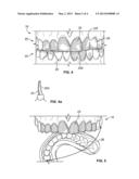 COSMETIC DENTAL PROCESS diagram and image