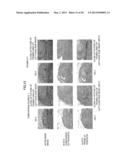 Method of Producing Tooth, Set of Teeth, and Method of Producing Tissue diagram and image