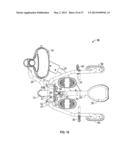 LATERAL DELTOID EXERCISE MACHINE WITH ROCKING USER SUPPORT diagram and image