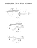 APPARATUS AND METHOD FOR INTRA-ABDOMINALLY MOVING A FIRST INTERNAL ORGAN     TO A POSITION AWAY FROM A SECOND INTERNAL ORGAN AND THEN HOLDING THE     FIRST INTERNAL ORGAN IN THE POSITION WITHOUT MANUAL INPUT diagram and image