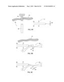 APPARATUS AND METHOD FOR INTRA-ABDOMINALLY MOVING A FIRST INTERNAL ORGAN     TO A POSITION AWAY FROM A SECOND INTERNAL ORGAN AND THEN HOLDING THE     FIRST INTERNAL ORGAN IN THE POSITION WITHOUT MANUAL INPUT diagram and image