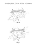 APPARATUS AND METHOD FOR INTRA-ABDOMINALLY MOVING A FIRST INTERNAL ORGAN     TO A POSITION AWAY FROM A SECOND INTERNAL ORGAN AND THEN HOLDING THE     FIRST INTERNAL ORGAN IN THE POSITION WITHOUT MANUAL INPUT diagram and image