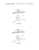 APPARATUS AND METHOD FOR INTRA-ABDOMINALLY MOVING A FIRST INTERNAL ORGAN     TO A POSITION AWAY FROM A SECOND INTERNAL ORGAN AND THEN HOLDING THE     FIRST INTERNAL ORGAN IN THE POSITION WITHOUT MANUAL INPUT diagram and image