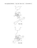 APPARATUS AND METHOD FOR INTRA-ABDOMINALLY MOVING A FIRST INTERNAL ORGAN     TO A POSITION AWAY FROM A SECOND INTERNAL ORGAN AND THEN HOLDING THE     FIRST INTERNAL ORGAN IN THE POSITION WITHOUT MANUAL INPUT diagram and image