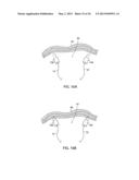 APPARATUS AND METHOD FOR INTRA-ABDOMINALLY MOVING A FIRST INTERNAL ORGAN     TO A POSITION AWAY FROM A SECOND INTERNAL ORGAN AND THEN HOLDING THE     FIRST INTERNAL ORGAN IN THE POSITION WITHOUT MANUAL INPUT diagram and image