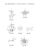 APPARATUS AND METHOD FOR INTRA-ABDOMINALLY MOVING A FIRST INTERNAL ORGAN     TO A POSITION AWAY FROM A SECOND INTERNAL ORGAN AND THEN HOLDING THE     FIRST INTERNAL ORGAN IN THE POSITION WITHOUT MANUAL INPUT diagram and image