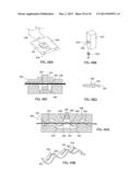 APPARATUS AND METHOD FOR INTRA-ABDOMINALLY MOVING A FIRST INTERNAL ORGAN     TO A POSITION AWAY FROM A SECOND INTERNAL ORGAN AND THEN HOLDING THE     FIRST INTERNAL ORGAN IN THE POSITION WITHOUT MANUAL INPUT diagram and image