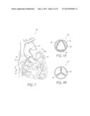 AORTIC VALVE POSITIONING SYSTEMS, DEVICES, AND METHODS diagram and image