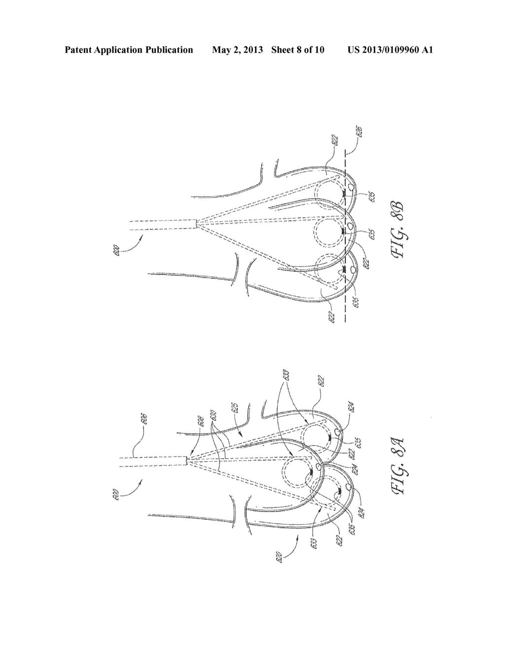 AORTIC VALVE POSITIONING SYSTEMS, DEVICES, AND METHODS - diagram, schematic, and image 09