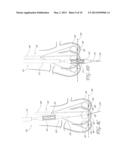 AORTIC VALVE POSITIONING SYSTEMS, DEVICES, AND METHODS diagram and image