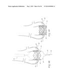 AORTIC VALVE POSITIONING SYSTEMS, DEVICES, AND METHODS diagram and image