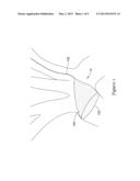 EXTENDED PROTECTION EMBOLIC FILTER diagram and image