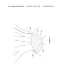 EXTENDED PROTECTION EMBOLIC FILTER diagram and image