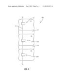 ATTACHMENT MECHANISM FOR MATERIAL AND BONE diagram and image