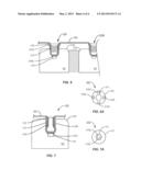 ATTACHMENT MECHANISM FOR MATERIAL AND BONE diagram and image