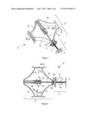 CRANIAL FIXATION DEVICE diagram and image