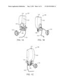 MICROPULSE GRID PATTERN LASER TREATMENT AND METHODS diagram and image