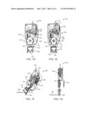 MICROPULSE GRID PATTERN LASER TREATMENT AND METHODS diagram and image