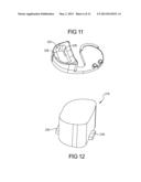 Knee Prosthesis Assembly With Ligament Link diagram and image