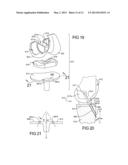 Knee Prosthesis Assembly With Ligament Link diagram and image