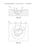 Patient-Specific Glenoid Guide And Implants diagram and image