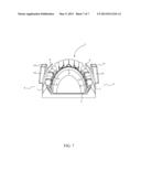 Oral Sleep Apnea Device diagram and image