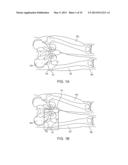 APPARATUS AND METHODS FOR CONFORMING A SUPPORT TO A BODY diagram and image