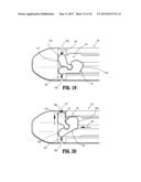 SURGICAL STAPLING APPARATUS diagram and image