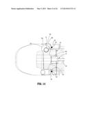 SURGICAL STAPLING APPARATUS diagram and image