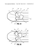 SURGICAL STAPLING APPARATUS diagram and image