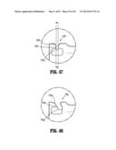 SURGICAL STAPLING APPARATUS diagram and image