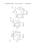 BROOM REST AND/OR BROOM HOLDER diagram and image