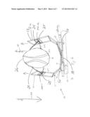 Head and Neck Restraining System diagram and image