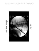 Imaging System and Method for Use in Surgical and Interventional Medical     Procedures diagram and image