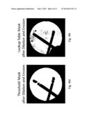 Imaging System and Method for Use in Surgical and Interventional Medical     Procedures diagram and image