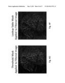 Imaging System and Method for Use in Surgical and Interventional Medical     Procedures diagram and image