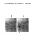 Imaging System and Method for Use in Surgical and Interventional Medical     Procedures diagram and image