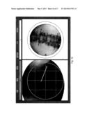 Imaging System and Method for Use in Surgical and Interventional Medical     Procedures diagram and image