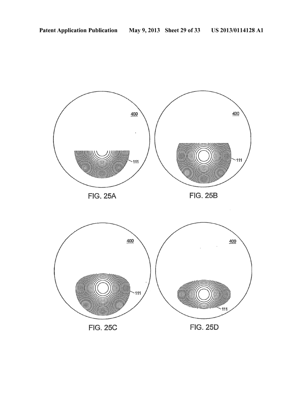 MULTIFOCAL LENS WITH A DIFFRACTIVE OPTICAL POWER REGION - diagram, schematic, and image 30