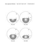 MULTIFOCAL LENS WITH A DIFFRACTIVE OPTICAL POWER REGION diagram and image